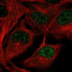 Immunofluorescence staining in SKMEL cell line with Anti-WWTR1 monoclonal antibody, showing spotty nuclear staining in green. Microtubule probes are visualized in red (where available).