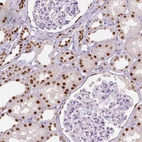 Immunohistochemical staining of human kidney shows strong nuclear positivity in cells in tubules.
