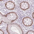 Immunohistochemical staining of human colon shows moderate to strong nuclear positivity in glandular cells.