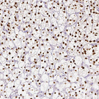 Anti-HNF1B Antibody