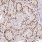 Anti-HNF1B Antibody