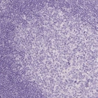Immunohistochemical staining of human tonsil shows no positivity in lymphoid cells as expected.