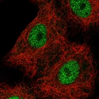 Immunofluorescence staining in A549 cell line with Anti-HNF1B monoclonal antibody, showing spotty nuclear (without nucleoli) staining in green. Microtubule probes are visualized in red (where available).