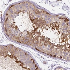 Anti-DICER1 Antibody