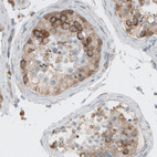 Immunohistochemical staining of human testis shows cytoplasmic positivity in the seminiferous tubules cells.