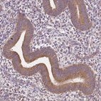 Immunohistochemical staining of human endometrium shows moderate cytoplasmic positivity in glandular cells.