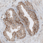 Immunohistochemical staining of human prostate shows cytoplasmic immunoreactivity in the glandular epithelium cells.