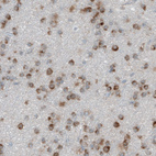 Immunohistochemical staining of human cerebral cortex shows cytoplasmic positivity in the glial cells.
