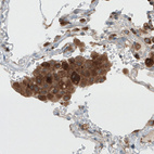 Anti-DICER1 Antibody