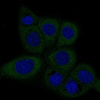 Immunofluorescence staining of A-431 cells using the anti-DICER1 monoclonal antibody, showing specific staining in the cytosol in green. Microtubule- and nuclear probes are visualized in red and blue, respectively (where available).