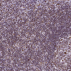 Anti-REST Antibody