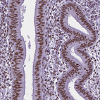 Anti-REST Antibody