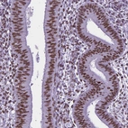 Immunohistochemical staining of human endometrium shows moderate nuclear positivity in glandular and stromal cells.
