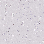 Immunohistochemical staining of human cerebral cortex shows no nuclear positivity in neuronal cells as expected.