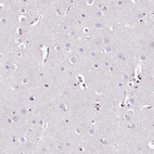 Anti-REST Antibody