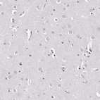 Immunohistochemical staining of human cerebral cortex shows no nuclear positivity in neuronal cells as expected.