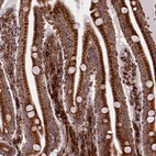 Immunohistochemical staining of human small intestine shows strong cytoplasmic positivity in glandular cells.