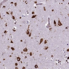 Immunohistochemical staining of human cerebral cortex shows strong cytoplasmic positivity in neurons.