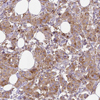 Anti-MTDH Antibody