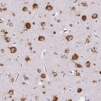Immunohistochemical staining of human cerebral cortex shows strong cytoplasmic positivity in neurons.