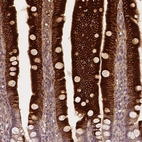 Immunohistochemical staining of human duodenum shows strong cytoplasmic positivity in glandular cells.