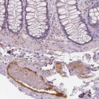 Immunohistochemical staining of human colon shows moderate positivity in plasma in blood vessels.