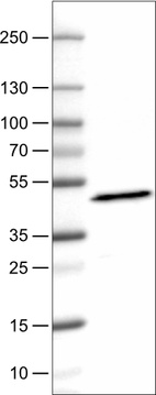 Lane 1: Marker [kDa]_br/_Lane 2: Human plasma