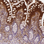 Immunohistochemical staining of human small intestine shows strong cytoplasmic positivity in glandular cells.