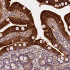 Anti-APOA4 Antibody