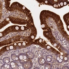 Immunohistochemical staining of human duodenum shows strong cytoplasmic positivity in glandular cells.