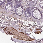Immunohistochemical staining of human colon shows strong positivity in plasma in blood vessels.