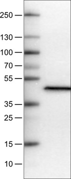 Lane 1: Marker [kDa]_br/_Lane 2: Human plasma