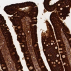 Immunohistochemical staining of human duodenum shows strong cytoplasmic positivity in glandular cells.