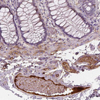 Anti-APOA4 Antibody