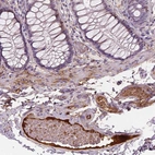 Immunohistochemical staining of human colon shows moderate positivity in plasma in blood vessels.