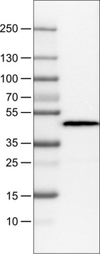 Lane 1: Marker [kDa]_br/_Lane 2: Human plasma