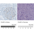 Anti-PLA2R1 Antibody