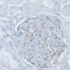 Immunohistochemical staining of human kidney shows weak membranous positivity in cells in glomeruli.