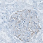 Anti-PLA2R1 Antibody