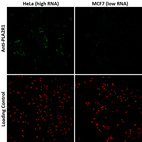 Anti-PLA2R1 Antibody