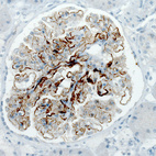 Anti-PLA2R1 Antibody