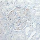 Anti-PLA2R1 Antibody