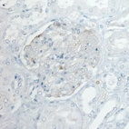 Immunohistochemical staining of normal human kidney shows very weak membranous positivity in cells in glomeruli.
