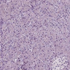 Immunohistochemical staining of human pancreas shows no positivity in exocrine glandular cells as expected.