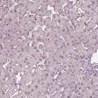 Anti-PLA2R1 Antibody