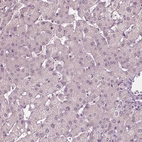 Immunohistochemical staining of human liver shows no positivity in hepatocytes as expected.