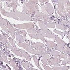 Immunohistochemical staining of human skeletal muscle shows no positivity in myocytes as expected.