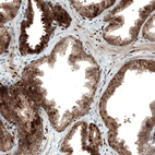 Immunohistochemical staining of human prostate shows moderate to strong nuclear and cytoplasmic positivity in glandular cells.