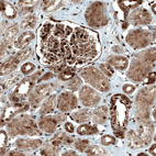 Immunohistochemical staining of human kidney shows moderate to strong nuclear 
 and cytoplasmic positivity in cells in glomeruli and tubuli.