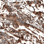 Anti-STAT3 Antibody